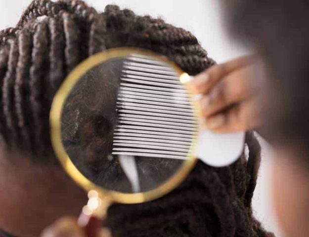 How To Kill And Get Rid Of Lice On Type 3-4 Natural Hair